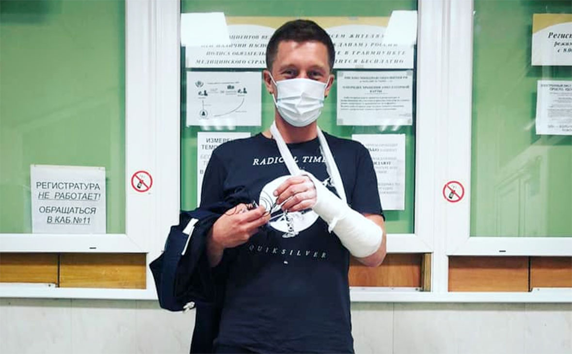 Режиссер сообщил о сломанной руке во время нападения на него и Собчак