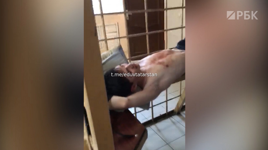СК сообщил о диагностированном у стрелка из Казани заболевании мозга
