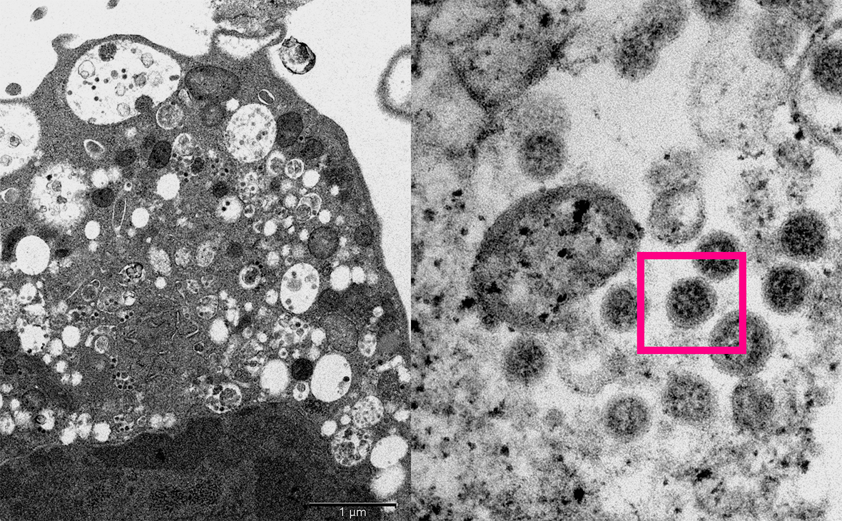 Ученые из Гонконга опубликовали первую фотографию омикрон-штамма